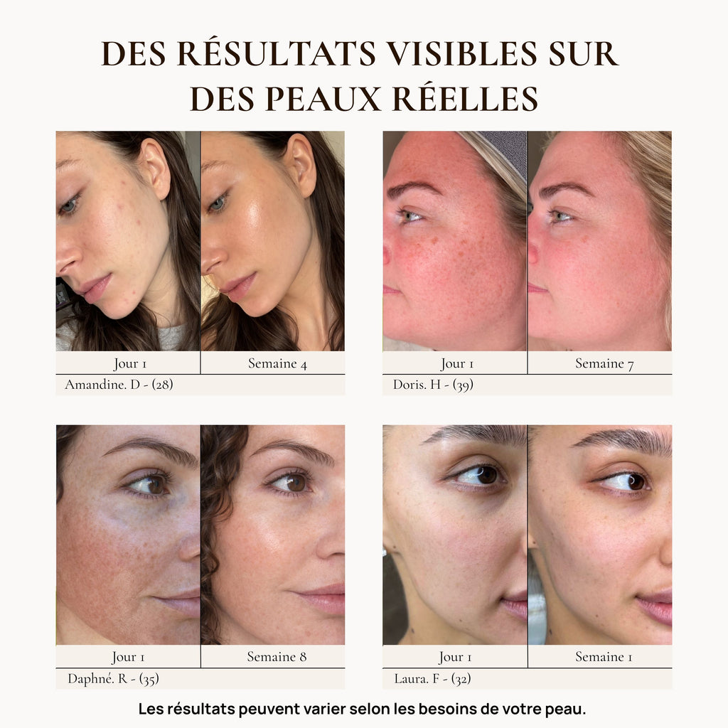 Masque jelly curcuma - Glow