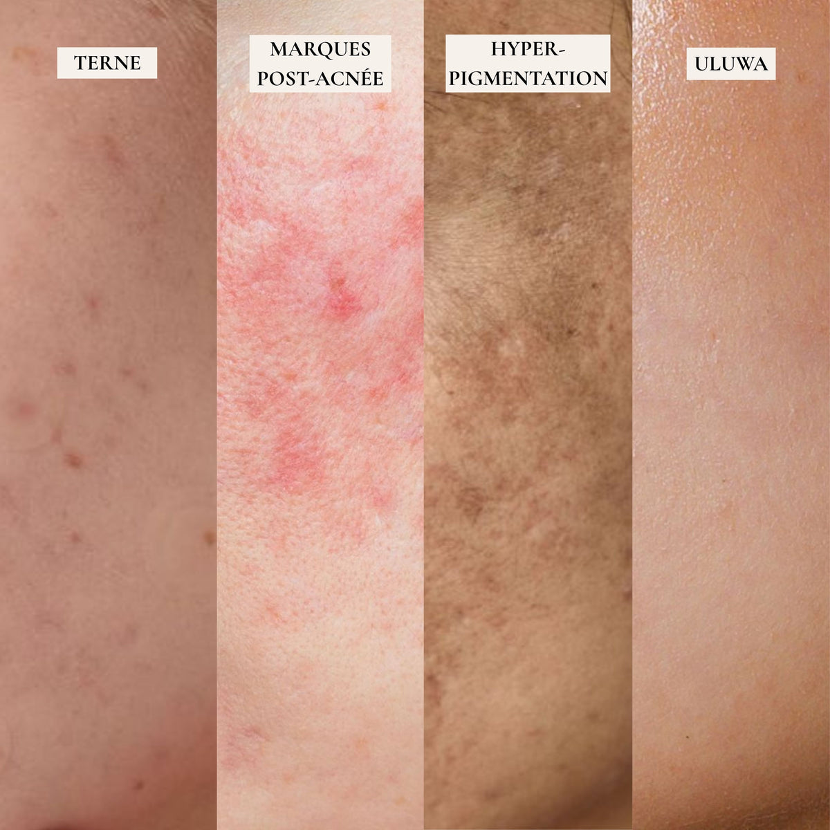 Masque jelly curcuma - Glow